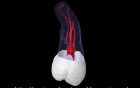 Maxillary Third Molar - Root Canal Anatomy