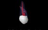 Maxillary Second Molar - Root Canal Anatomy - 4