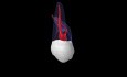 Maxillary Second Molar - Root Canal Anatomy - 4