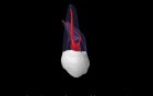 Maxillary Second Molar - Root Canal Anatomy - 4
