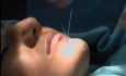 Effects of Chin enhancement and dimple formation