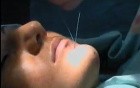 Effects of Chin enhancement and dimple formation