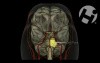Normal Cerebral Anatomy and Physiology