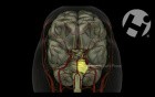 Normal Cerebral Anatomy and Physiology