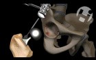 Future Hip Replacement