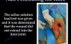 Nail Penetrating the Knee - Video Lecture