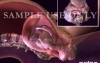 Childbirth - Normal Vaginal Delivery 