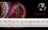 Anatomy and Location of Cesarean Scar