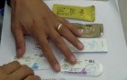 Dental Sutures - Which One To Choose?