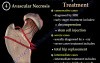 Common causes of Hip Pain - Video Lecture