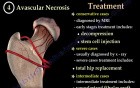 Common causes of Hip Pain - Video Lecture