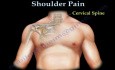 Shoulder Pain - Anatomy and Examination