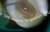 Good endo poorly done
