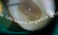 Good endo poorly done