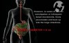 Fecal Impaction