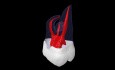 Root Canal Anatomy of Maxillary Second Molar