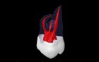 Root Canal Anatomy of Maxillary Second Molar
