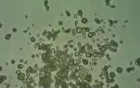 Urinoscopy - Cylindruria - 2