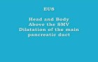 EUS of acute pancreatitis