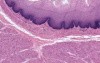Esophagus - Histology