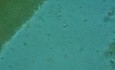 Microbiological testing of feces