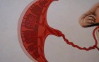 Congenital Heart Defects and Fetal CV - Lecture - 1/4