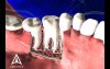 Tooth Anatomy - 3D Medical Animation 