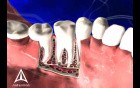 Tooth Anatomy - 3D Medical Animation 
