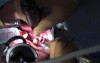 Bone Graft - Ramus Osteotomies And Harvesting Block