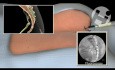 Caudal Procedure