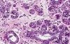 Vocal Cords - Histology