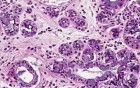 Vocal Cords - Histology