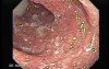 Rectum (13 of 30)