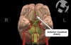 Normal Anatomy of the Brain