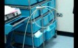Laser liposuction surgery