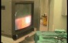 Laparoscopy