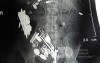 Multiple Foreign bodies in the GI tract (4 of 12)
