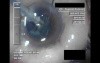 Swollen Conjunctiva - Part 3
