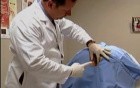 Internal haemorrhoids - Infrared coagulation