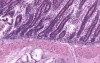 Duodenum - Histology