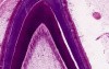 Tooth Eruption - Histology