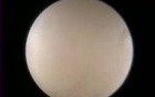 Neuroendoscopy course video