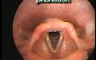 Laryngeal Movements and vocal folds positions