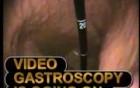 Gastroscopy - Presentation Of A Health Centre Providing I.A. Endoscopy Of GI System