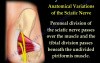 Piriformis Syndrome - Video Lecture