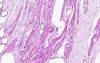 Female Urethra - Histology