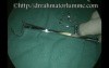 Uvulopalatal Retraction Device for Exposure of Nasopharynx
