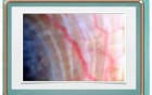 Glaucoma and lymphatics surgery