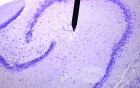 Hippocampal Formation