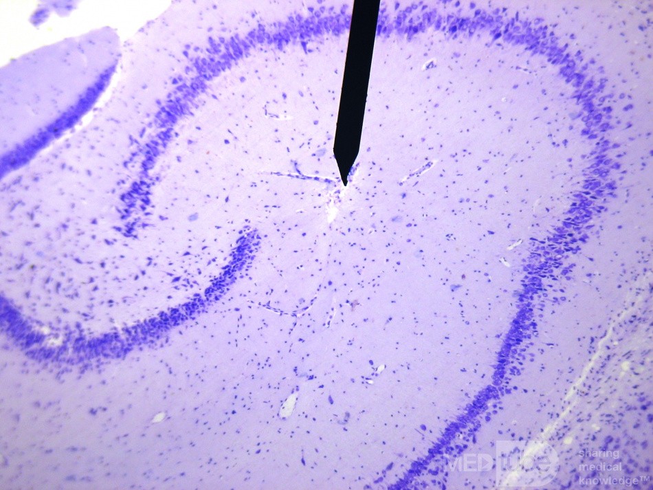 Hippocampal Formation